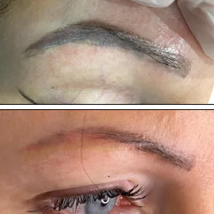 right eyebrow