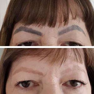 eyebrows