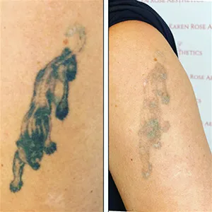 faded tattoo