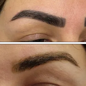 both eyebrows